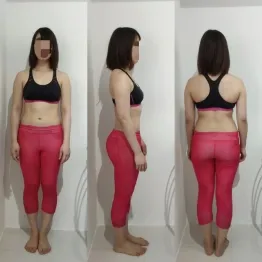 20代前半 女性 After