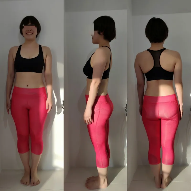 30代前半 女性 Before