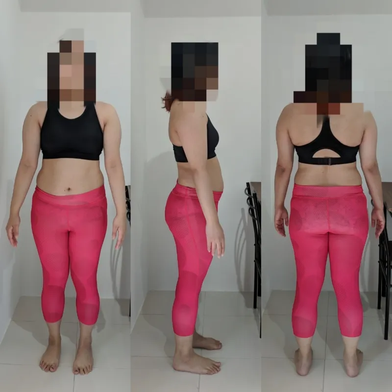 30代前半 女性 Before