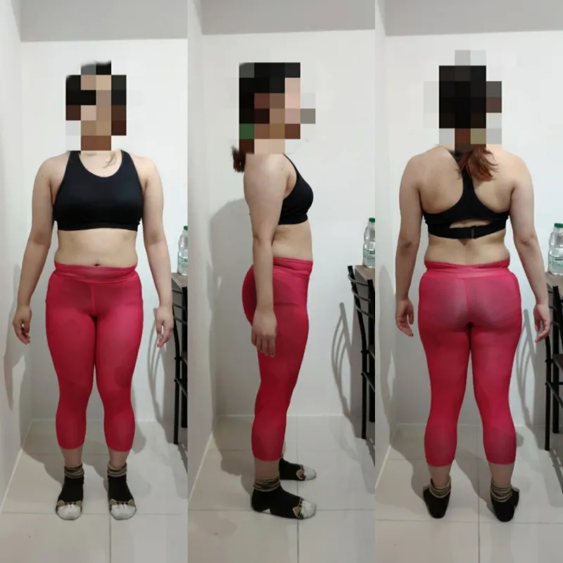 30代前半 女性 After