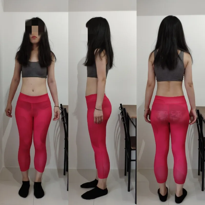 20代後半 女性 Before