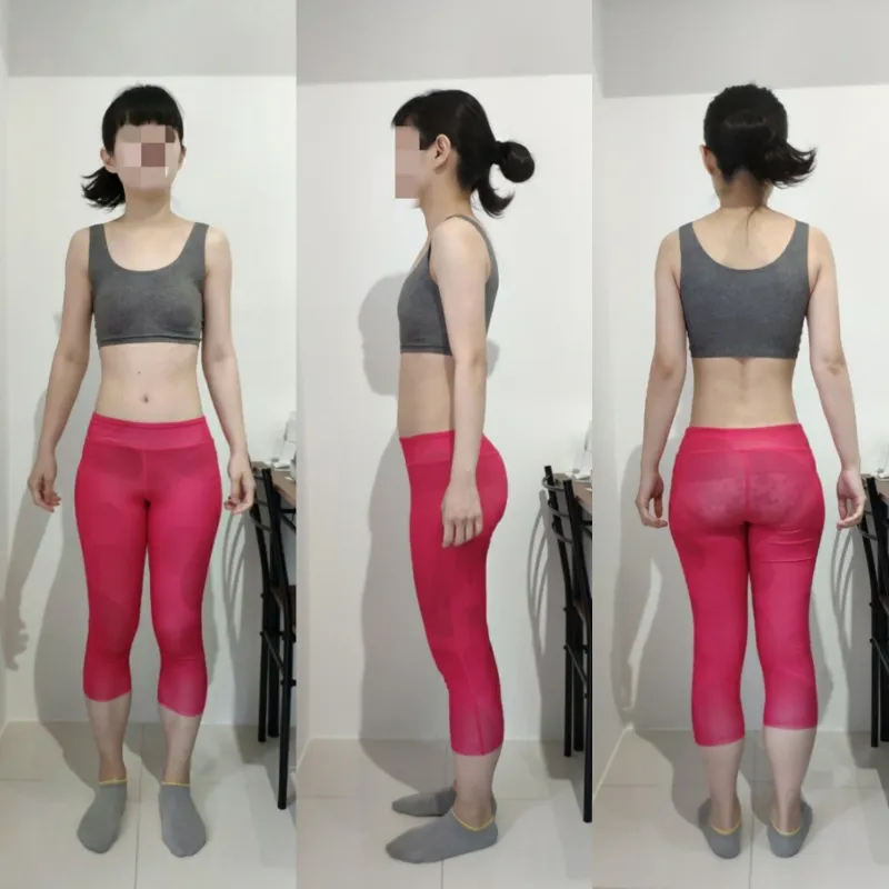 20代後半 女性 After