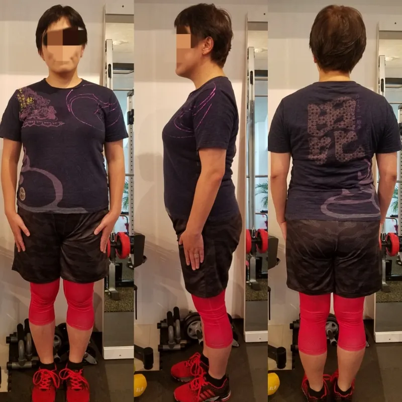 40代半ば 女性 Before