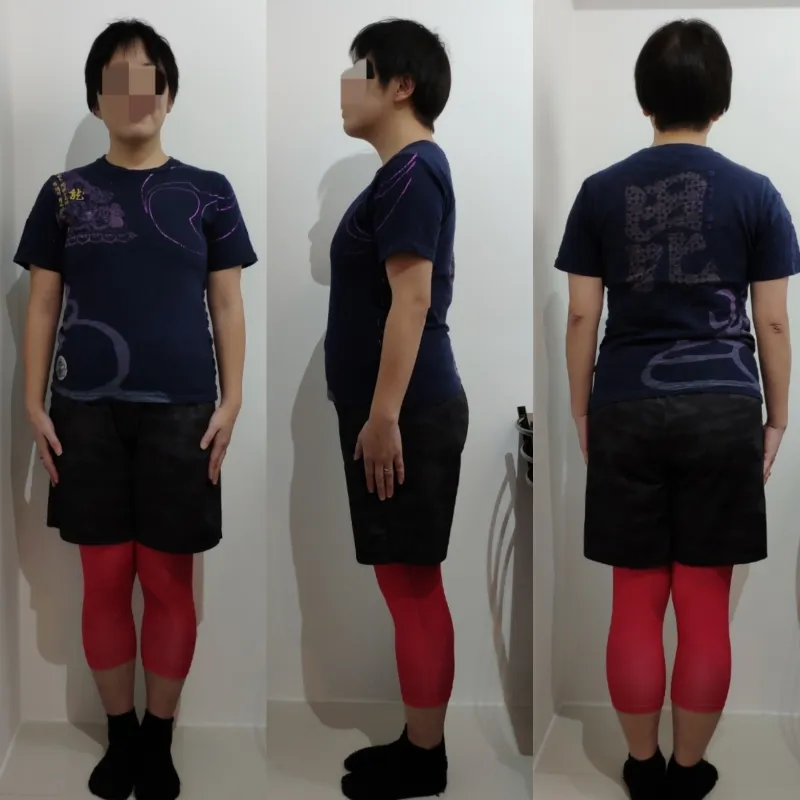 40代半ば 女性 After