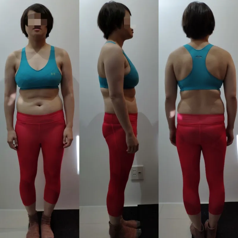 30代前半 女性 Before