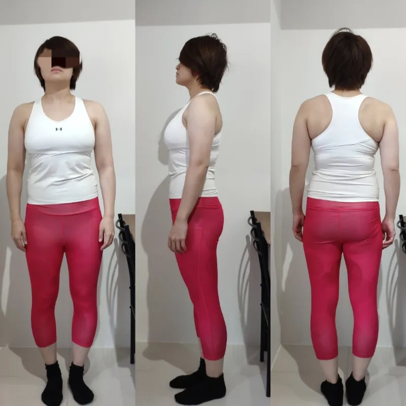 30代前半 女性 After