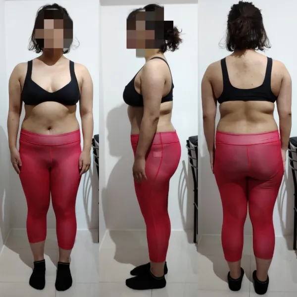 20代後半 女性 Before