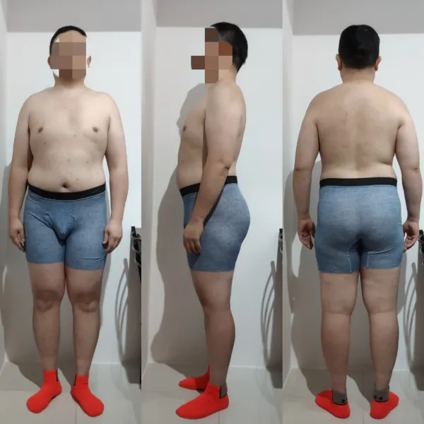 30代後半 男性 After