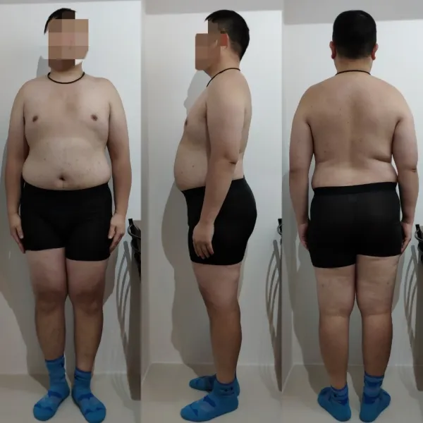 30代後半 男性 Before