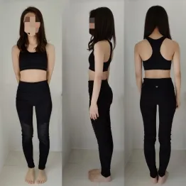 20代後半 女性 Before