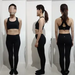 20代後半 女性 After